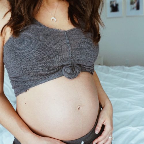 how to prevent stretch marks during pregnancy